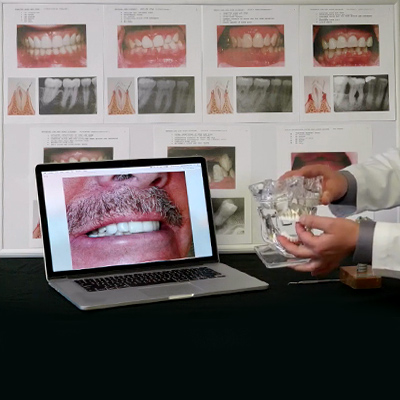 ​​​​​​​Dental Implant