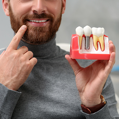 Same Day Dental Implants